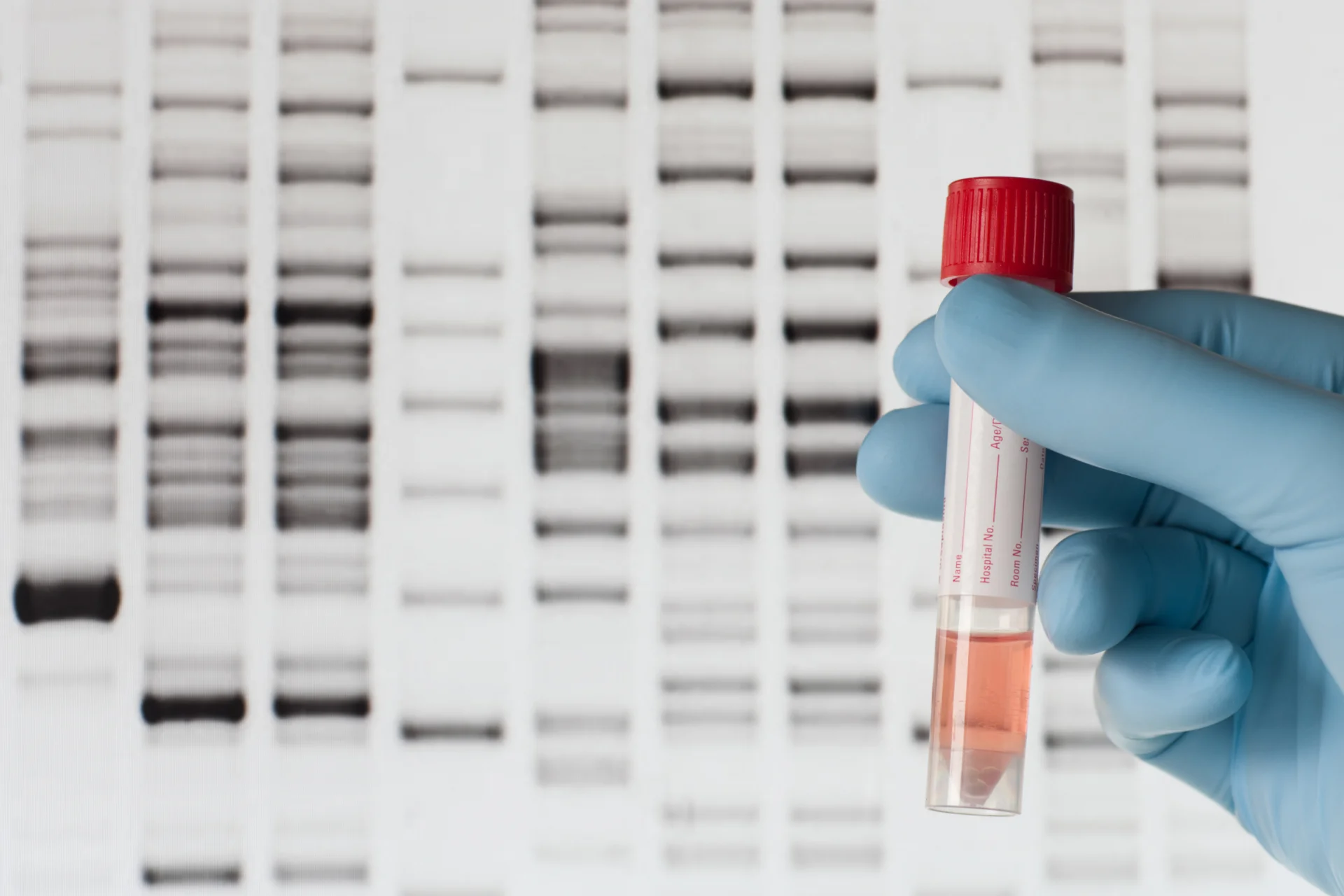 A gloved lab technician's hand holding a sample tube against a backdrop of DNA gel-electrophoresis bands.